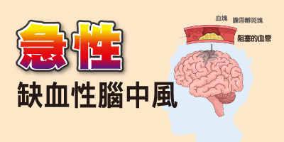 認識腦中風─【急性缺血性腦中風】