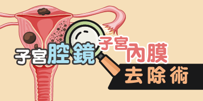 子宮腔鏡子宮內膜去除術